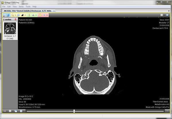 Ginkgo CADx Pro(醫(yī)學圖像瀏覽)